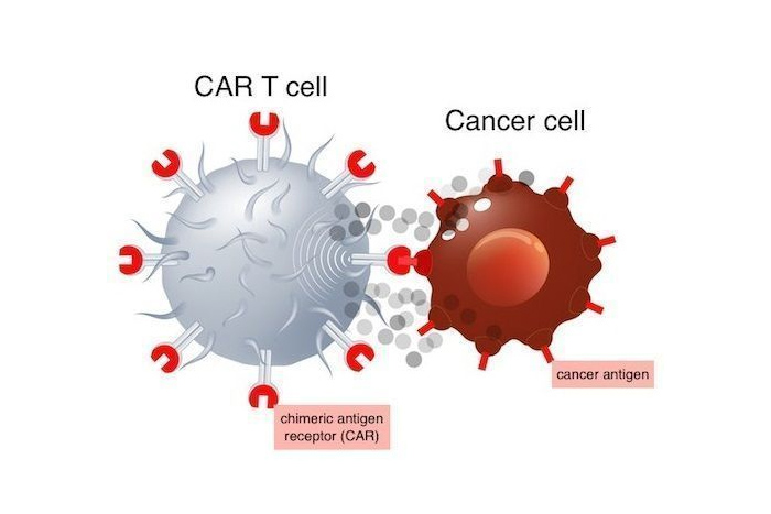 CD19 car-t cell therapy! Novartis kymriah for recurrent / refractory B-cell acute lymphoblastic leuk